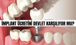 İmplant ücretini devlet karşılıyor mu? Devlet hastanelerinde implant ücreti ne kadar?