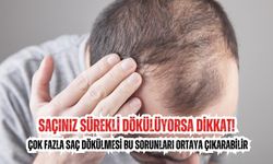 Saçınız sürekli dökülüyorsa dikkat! Çok fazla saç dökülmesi bu sorunları ortaya çıkarabilir