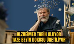 Alzheimer hastalığı tarihe karışıyor | Taze beyin dokusu üretilecek