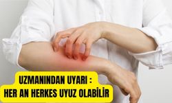 Dikkat uyuz olabilirsiniz !10 saniyelik yakın temasla insandan insana bulaşıyor