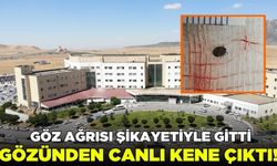 Göz ağrısı şikâyetiyle gitti: Gözünden canlı kene çıkarıldı