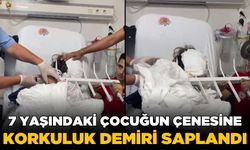 Küçük çocuğun kafasına korkuluk demiri saplandı