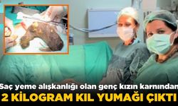 20 yaşındaki genç kızın midesinden 2 kiloluk kıl yumağı çıktı