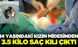 14 yaşındaki kızın midesinden 3.5 kilo saç kılı çıktı