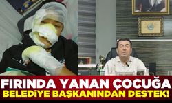 Arkadaşlarının fırına kilitlemesi sonucu yanan çocuğa, belediye başkanı destek çıktı