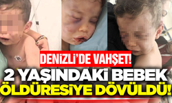 Denizli'de 2 yaşındaki bebek, annesinin sevgilisi tarafından öldüresiye dövüldü