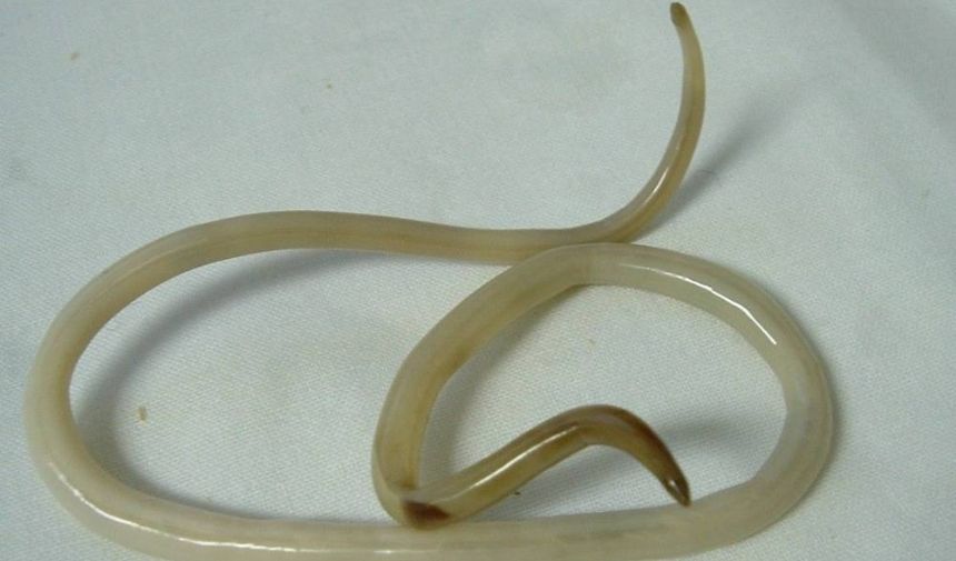 3 Saatte Kıl Kurdu Nasıl Dökülür Müthiş Yöntem