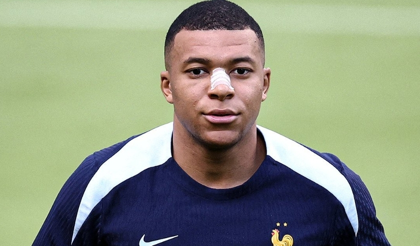 Kylian Mbappe Neden Maske Takıyor (2)