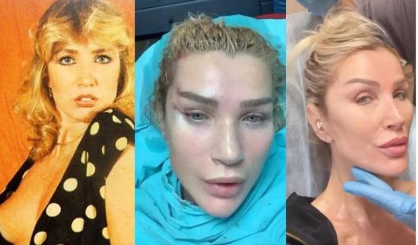 Seda Sayan'ın Estetiksiz Hali